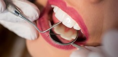 endodoncia