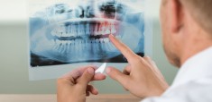 radiologia-e-imagenologia-oral-y-maxilofacial